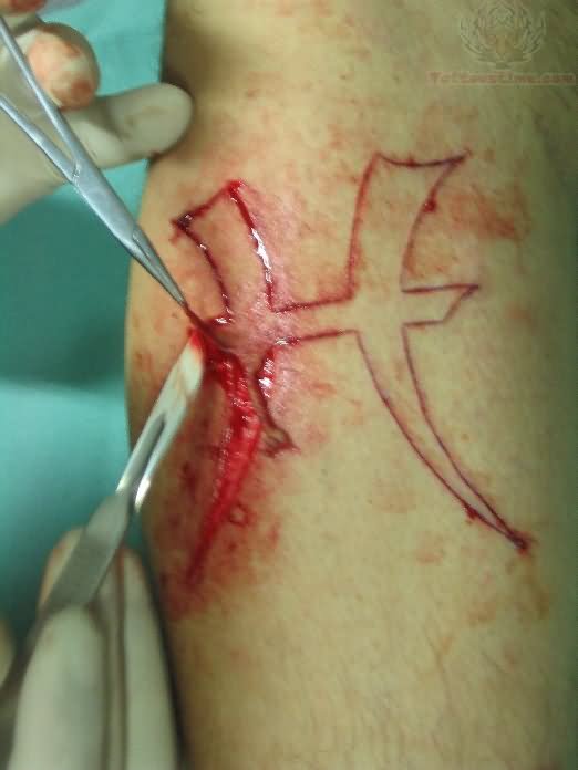 Scarification Tattoo In Process