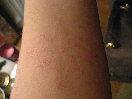 Star Light Tattoo On Left Forearm